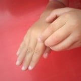 虫刺され 蚊 かゆみ 子供 手