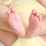 赤ちゃん 足 付け根 股関節