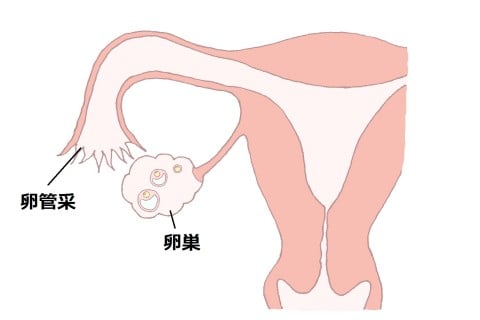 イラスト 卵管卵巣1