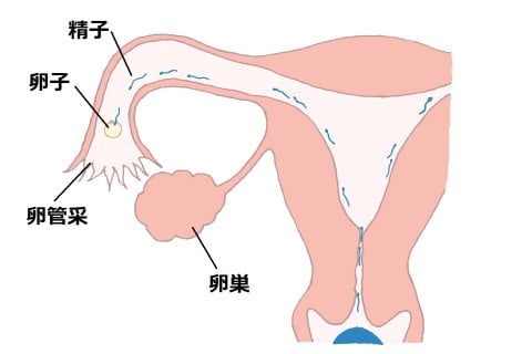 イラスト 卵管卵巣3