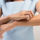 かゆい 女性 痒み 腕