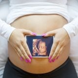 超音波検査 エコー検査 エコー写真 3Dエコー