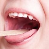 溶連菌 子供 のど 痛み 病院 検査 診断