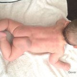 蒙古斑 生後5ヶ月