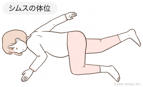シムスの体位
