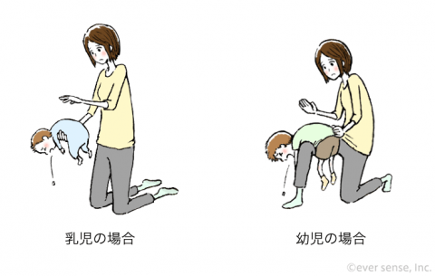 誤飲 誤嚥 イラスト 背部叩打法