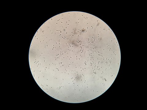 精子
