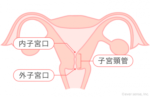 子宮「頸」管 子宮頸管 子宮頚管