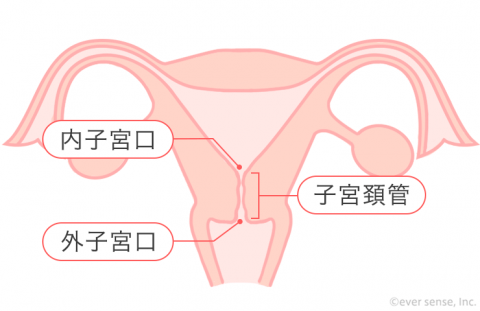 子宮「頚」管 子宮頚管 子宮頸管