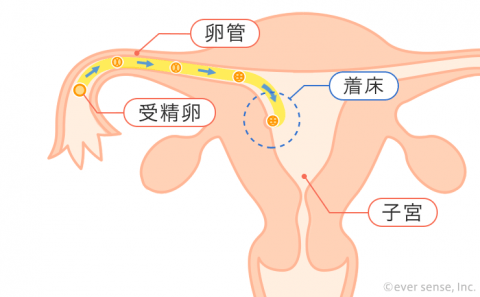 着床 受精卵 卵管 子宮