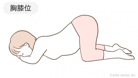 胸膝位 体位