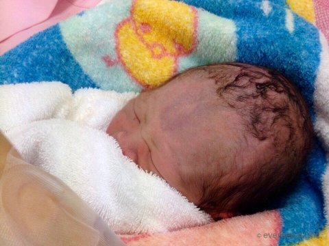 妊娠・出産体験記 オリジナル 出産 赤ちゃん 新生児 A ロゴ入り