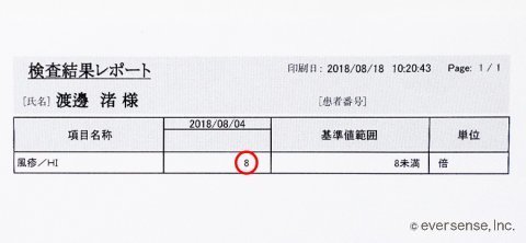 風疹 検査