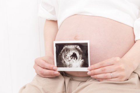 妊婦 お腹 エコー