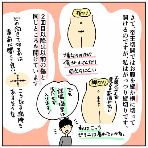 ツルリンゴスター 出産体験記 5話