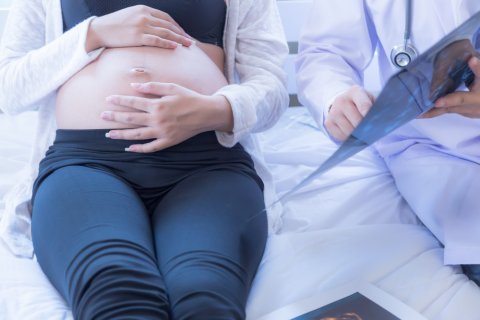 帝王切開 妊婦 医師