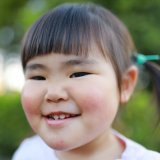受け口 女の子 日本人 子供