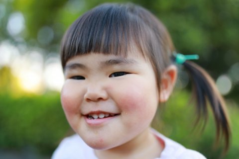受け口 女の子 日本人 子供