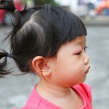 目 ものもらい 病気 日本人 子供
