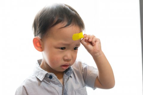たんこぶ 子供 日本人 怪我 おでこ
