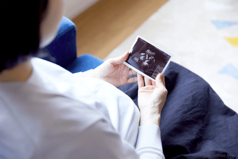 オリジナル 妊婦 エコー写真 日本人